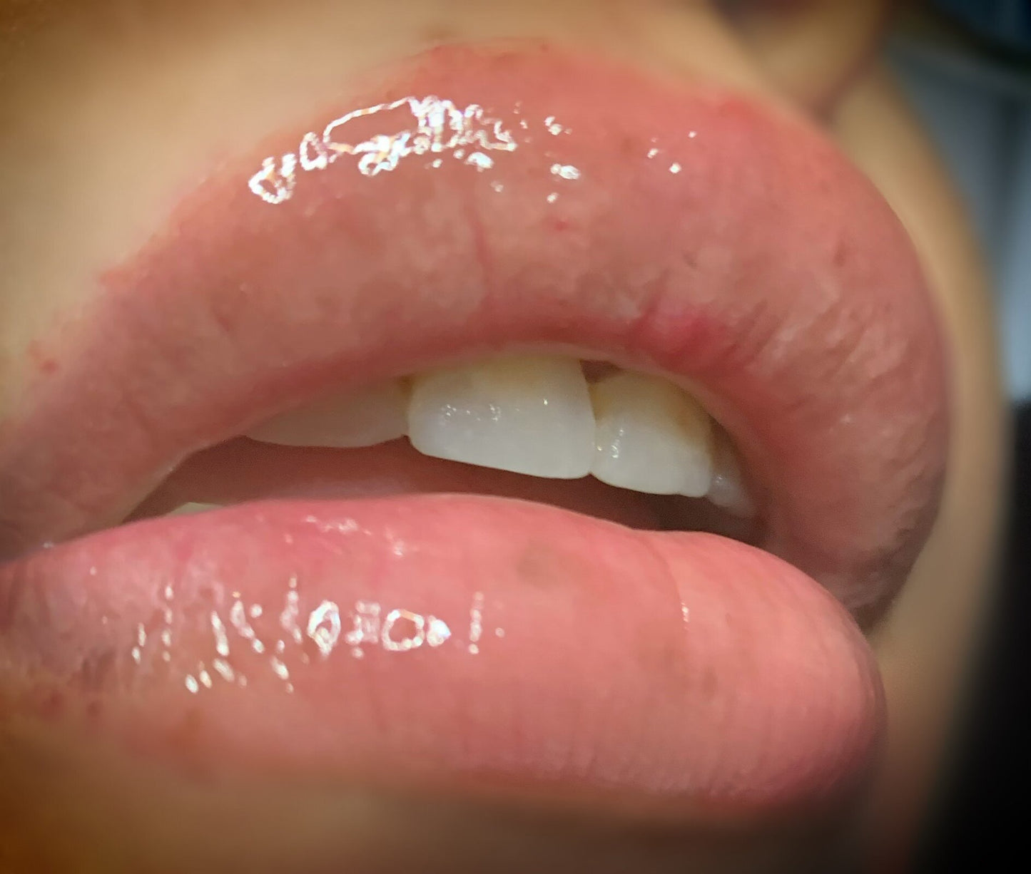 Mist Lip Butter